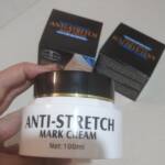 کرم رفع ترک شکم و بدن اصل آیچون بیوتی(Aichun Beauty)