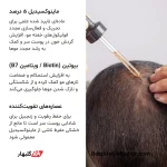پکیج ماینوکسیدیل سادور | مجموعه سه‌گانه ضد ریزش و رشد مجدد مو