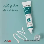 کرم ضد لک و روشن‌کننده مویام | روشن‌کننده و رفع کک‌ومک با فرمولاسیون تخصصی